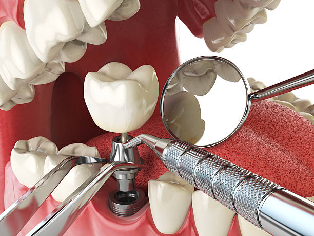 Best Emergency Cosmetic Dentistry (e.g., broken veneers) in Rossvle, IL
